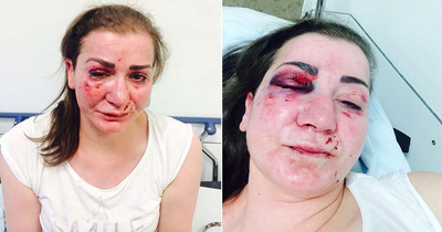 Köln‘de Türk kadına tramvayda saldırı