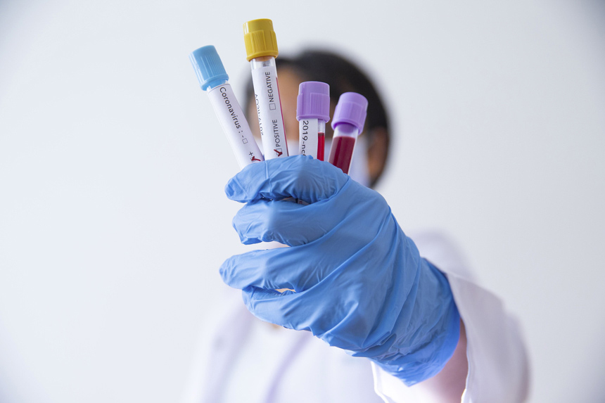 Almanya'da bazı test merkezlerine usulsüzlük soruşturmsı açıldı Almanya'da bazı test merkezlerine usulsüzlük soruşturmsı açıldı
