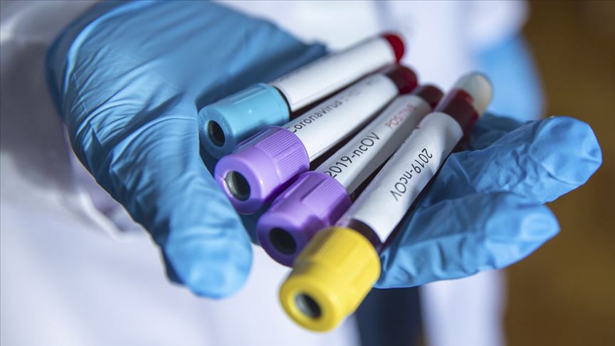 NRW Eyaleti’nde 5203 öğrencide koronavirüs çıktı NRW Eyaleti’nde 5203 öğrencide koronavirüs çıktı