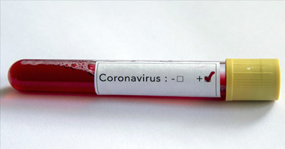 Almanya'da koronavirüsten 6 Türk vatandaşı daha hayatını kaybetti