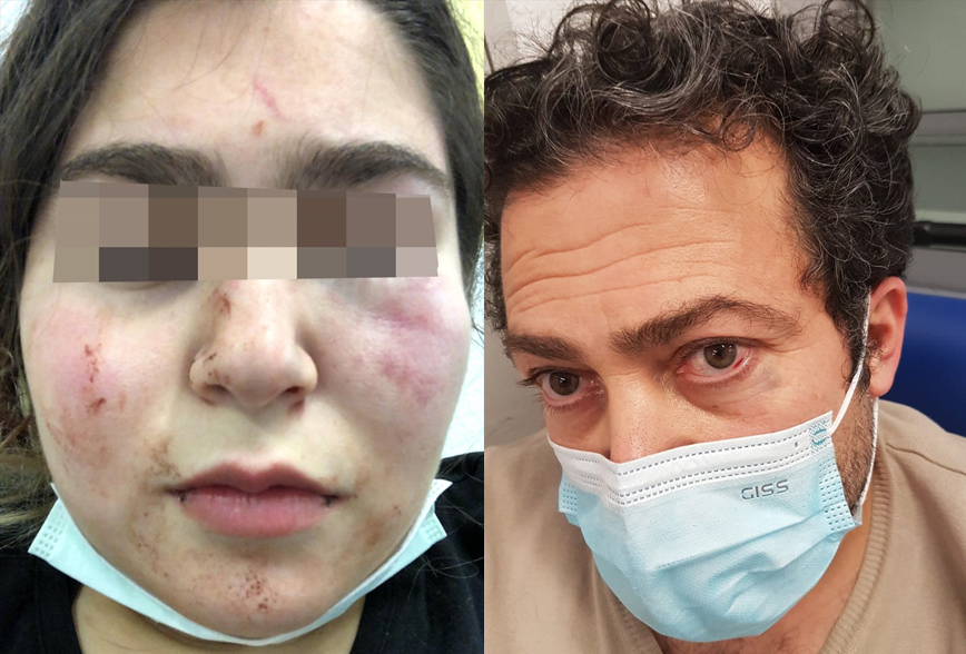Almanya’da baba kıza polis şiddeti Almanya’da baba kıza polis şiddeti