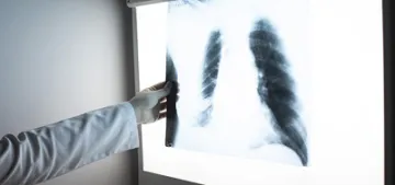 Uzun süren öksürük ihmal edilmemeli