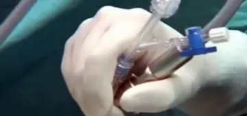 Ameliyat sırasında tedavi değiştiren doktora tazminat ödemek zorunda