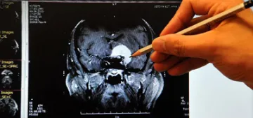 Kadınların beyni erkeklerden daha aktif çalışıyor Kadınların beyni erkeklerden daha aktif çalışıyor