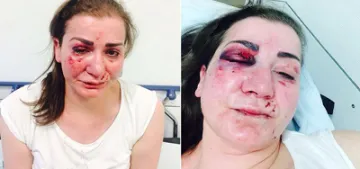 Köln‘de Türk kadına tramvayda saldırı