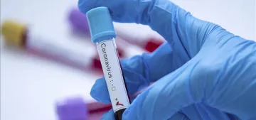 Almanya’da koronavirüsten 818 Türk vatandaşı vefat etti