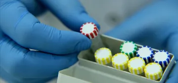 5 Türk vatandaşı daha koronavirüsten hayatını kaybetti 5 Türk vatandaşı daha koronavirüsten hayatını kaybetti