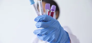 Almanya'da koronavirüsten ölenlerin sayısı 85 bini geçti Almanya'da koronavirüsten ölenlerin sayısı 85 bini geçti