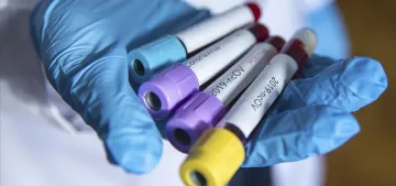 NRW Eyaleti’nde 5203 öğrencide koronavirüs çıktı NRW Eyaleti’nde 5203 öğrencide koronavirüs çıktı