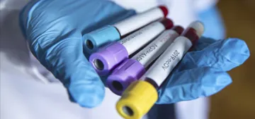 Almanya'da 3 Türk daha koronavirüsten öldü Almanya'da 3 Türk daha koronavirüsten öldü