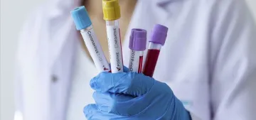 Almanya’da Koronavirüs kaynaklı ölüm sayısı 25 bini geçti