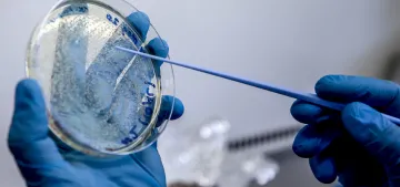 Hepatit virüsü taşıyan 10 kişiden 9'u bundan habersiz