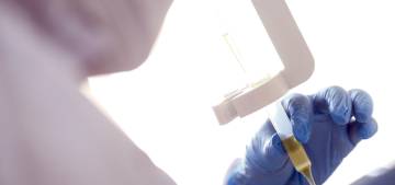2017’de AIDS nedeniyle 940 bin kişi öldü