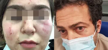 Almanya’da baba kıza polis şiddeti Almanya’da baba kıza polis şiddeti